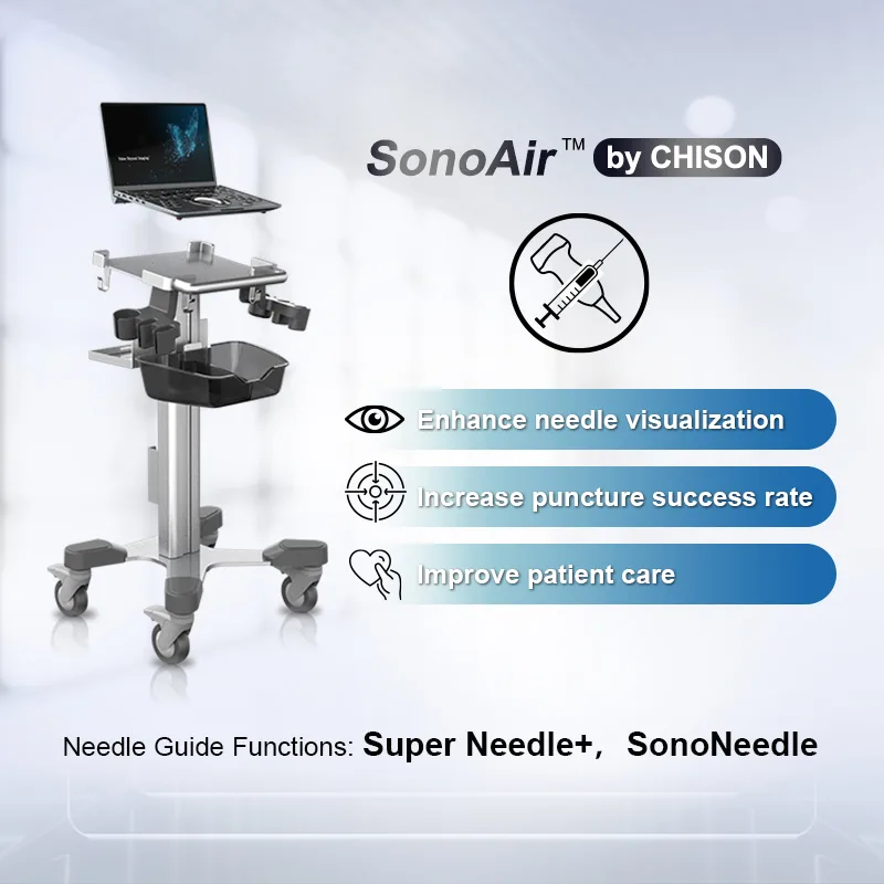 CHISON Medical Technologies Co., Ltd. - Health & Medical products | China
