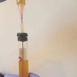PRP Plasmolifting - Health & Medical products | United States