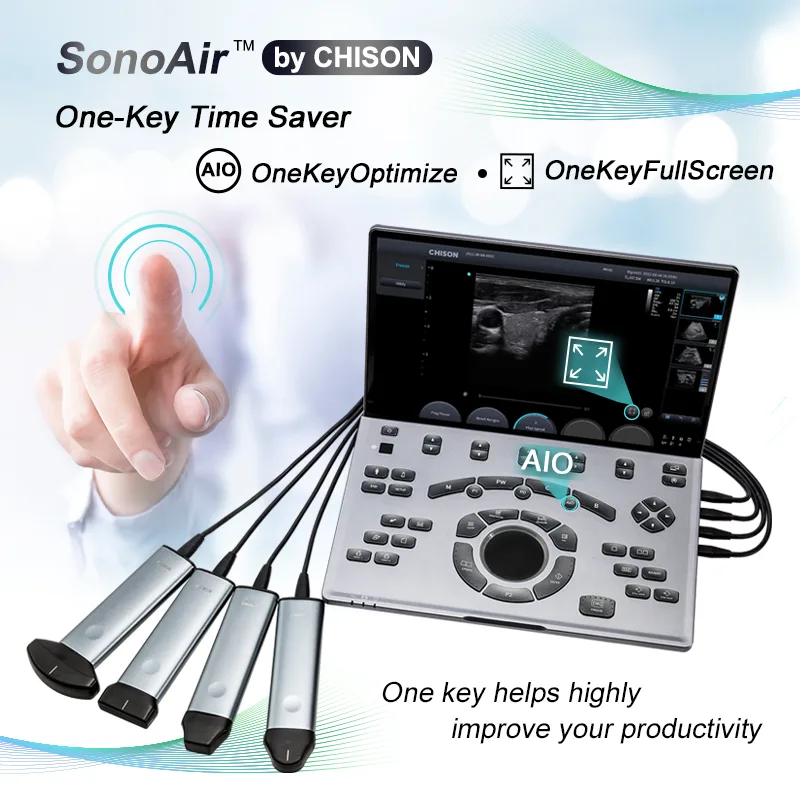CHISON Medical Technologies Co., Ltd. - Health & Medical products | China