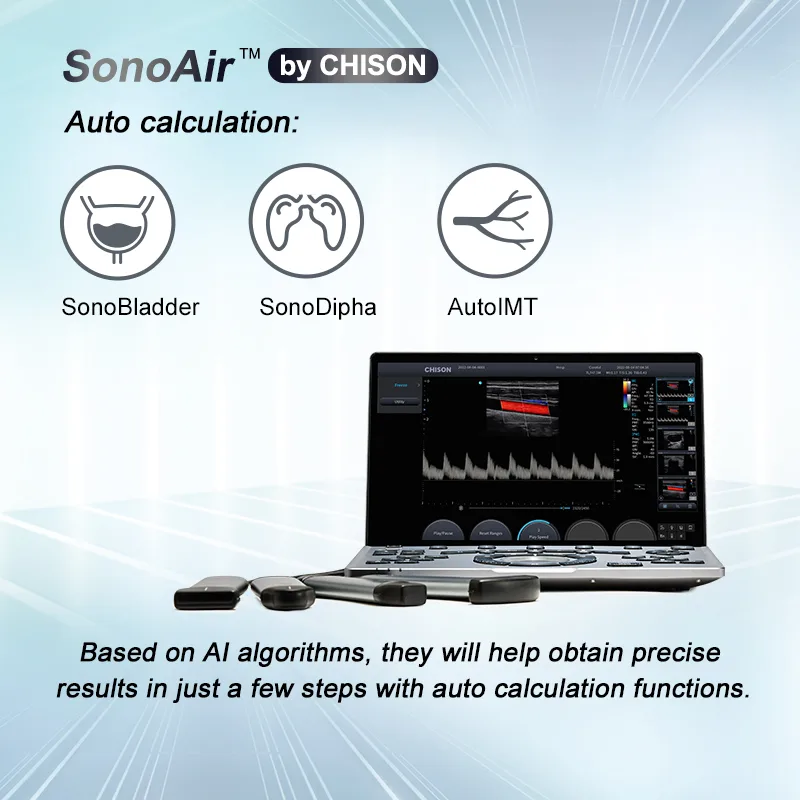 CHISON Medical Technologies Co., Ltd. - Health & Medical products | China